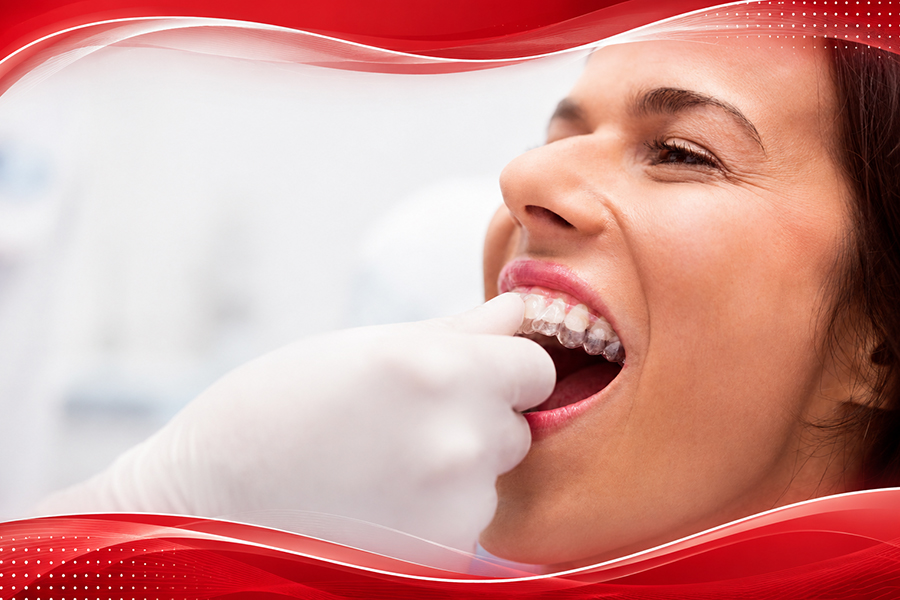Affordable Invisalign in Katy TX